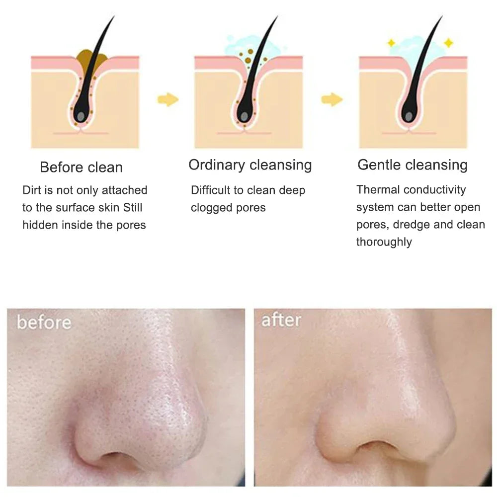 Electric Facial Cleansing Brush